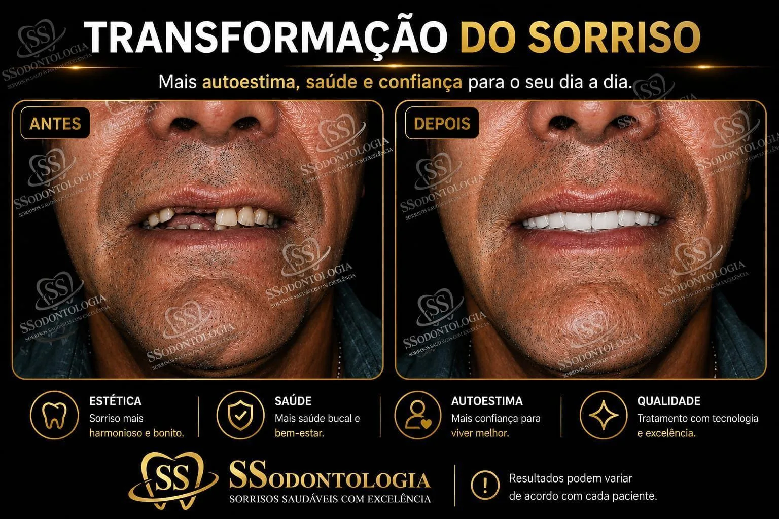 Antes e depois: Prótese Dentária