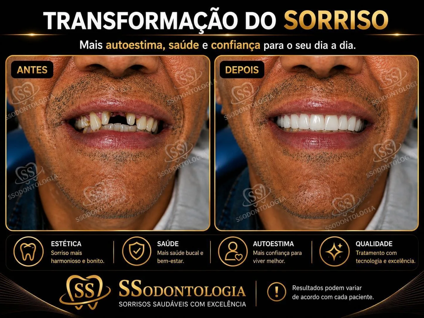 Antes e depois: Estética Dental