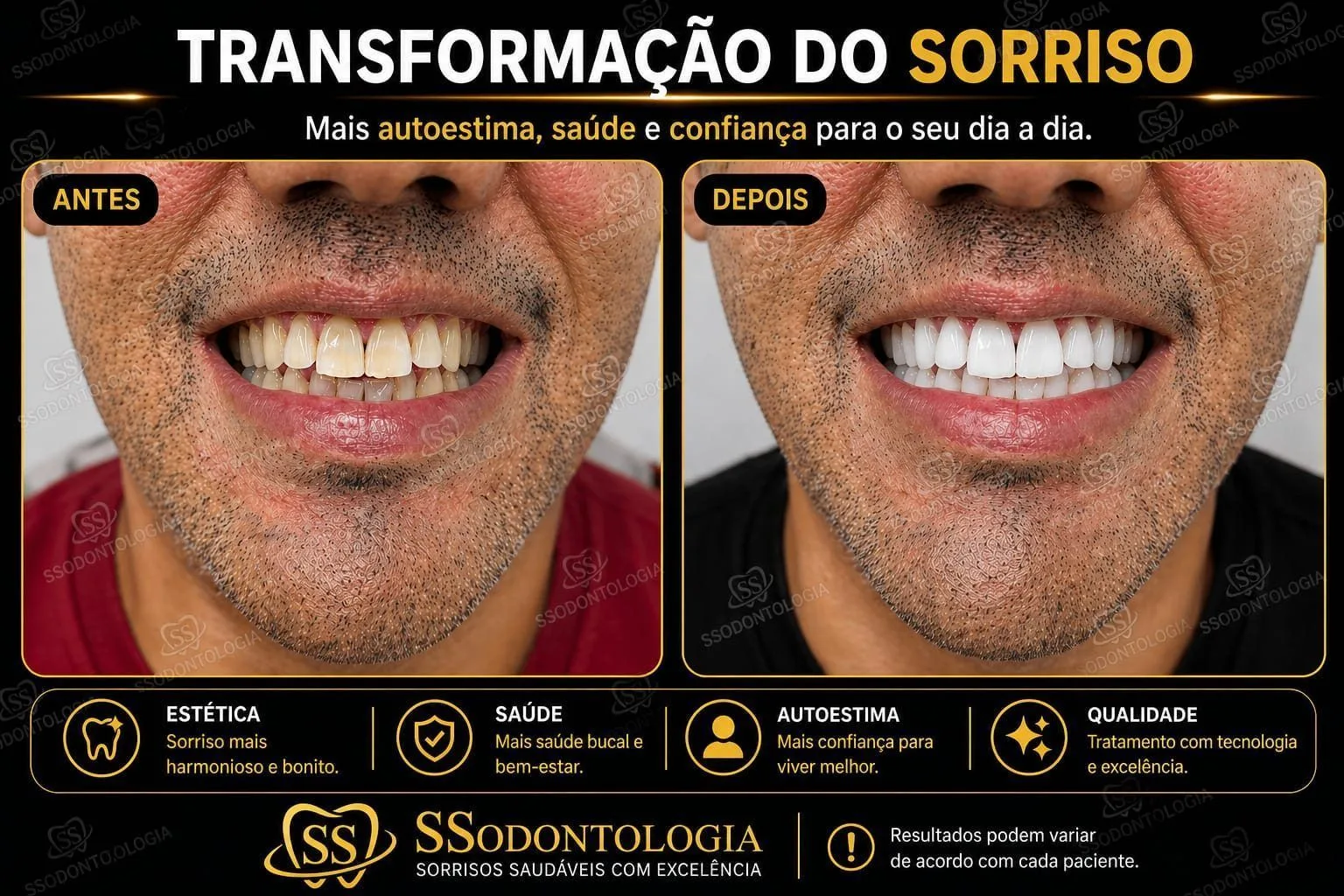 Antes e depois: Estética e Clareamento