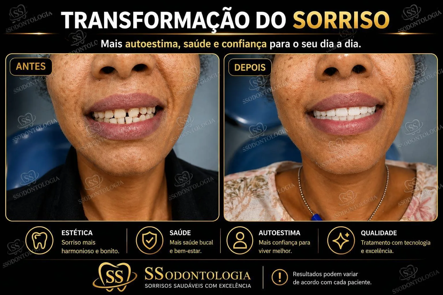 Antes e depois: Estética Dental