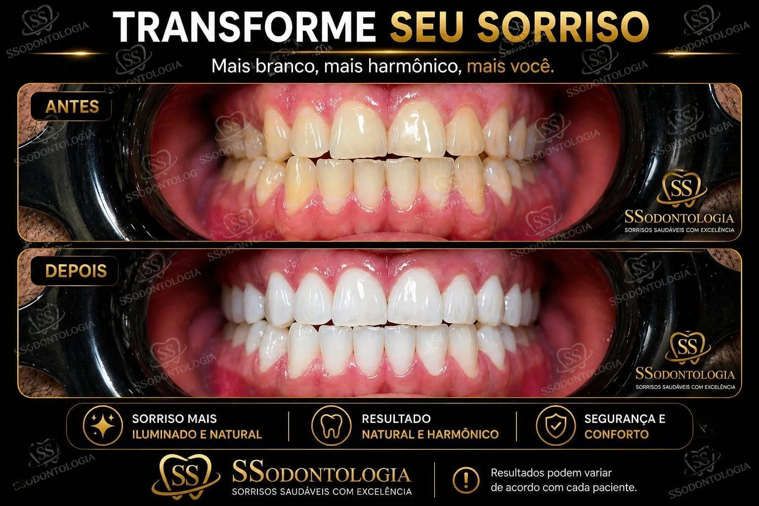 Antes e depois: Reabilitação Oral